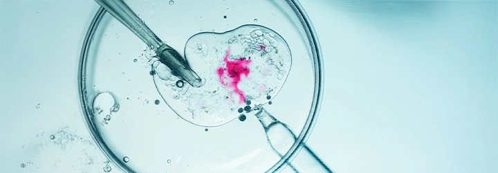 Akupunktur kıbrıs ivf